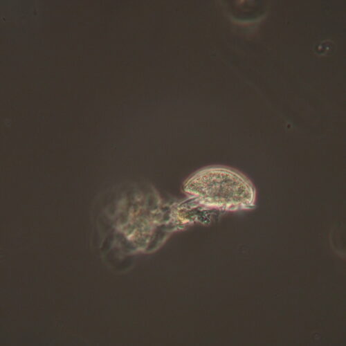 Aspidisca spp. at 400x magnification