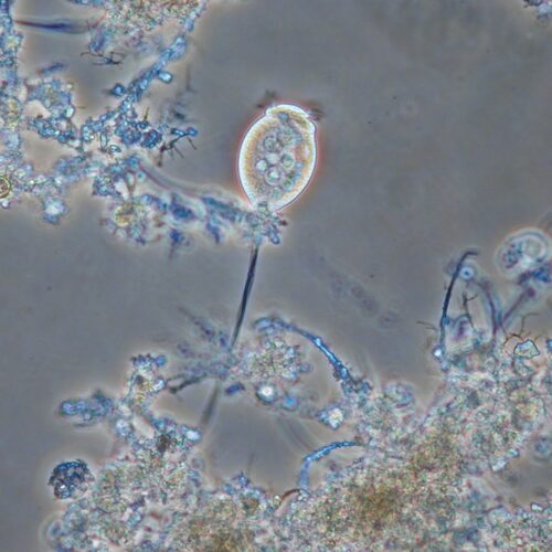 Vorticella microstoma 400X (Foto Dr. Marina Ettl)