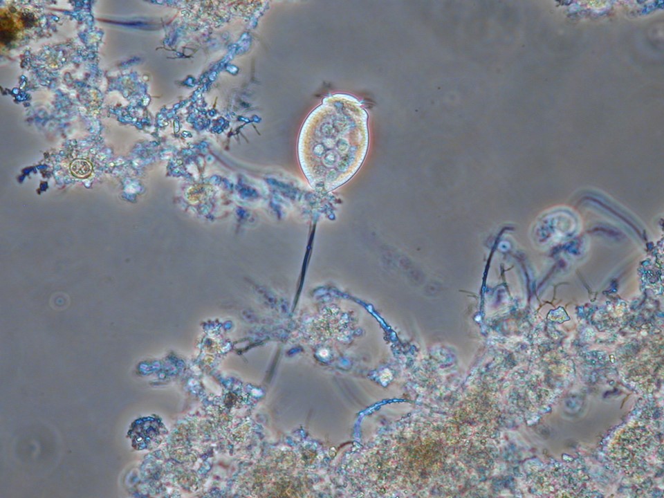 Vorticella microstoma 400X (Foto Dr. Marina Ettl)